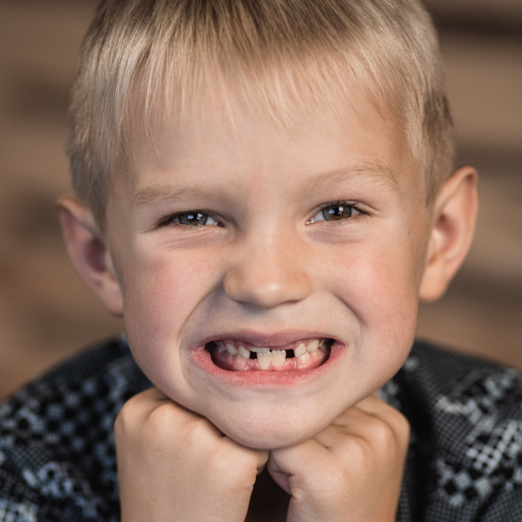 Kid smiling with missing teeth